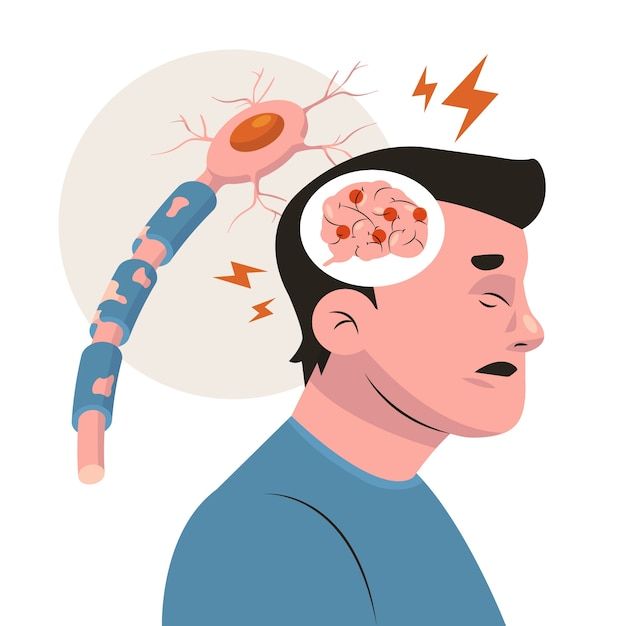 Cara Merawat Minor Stroke dengan Fisioterapi: Pendekatan Efektif untuk Pemulihan