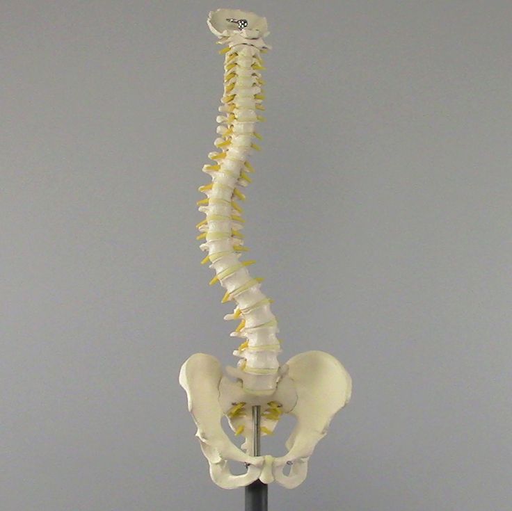 Scoliosis